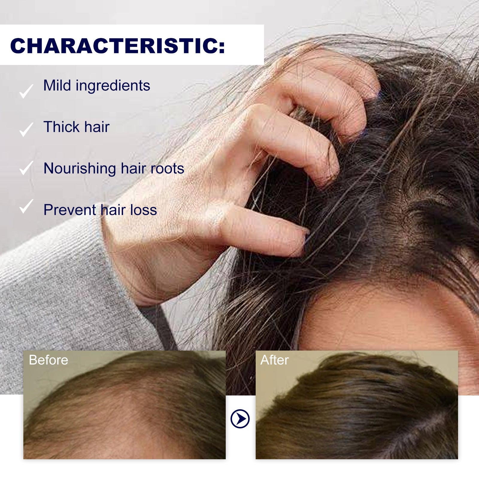 Hoegoa - Potent GRO Hair Treatment Roller