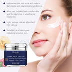 Hoygi - Dark Spot Cream