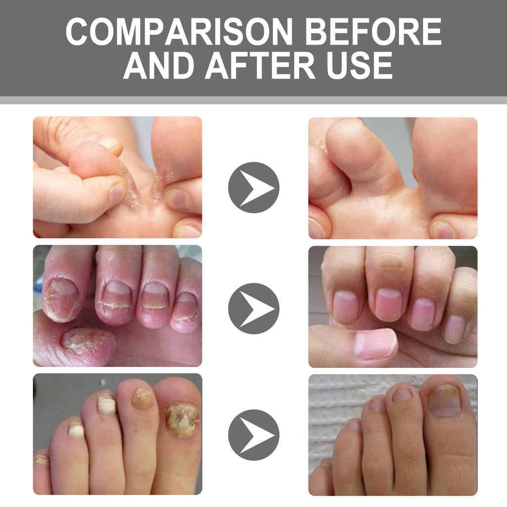 XiMonth - Nail Care Cream