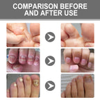 XiMonth - Nail Care Cream