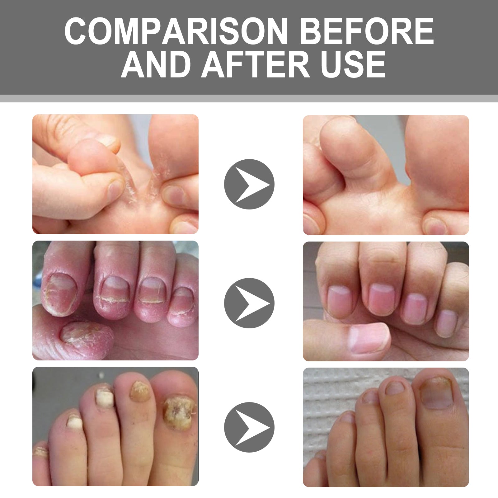 XiMonth - Nail Care Cream