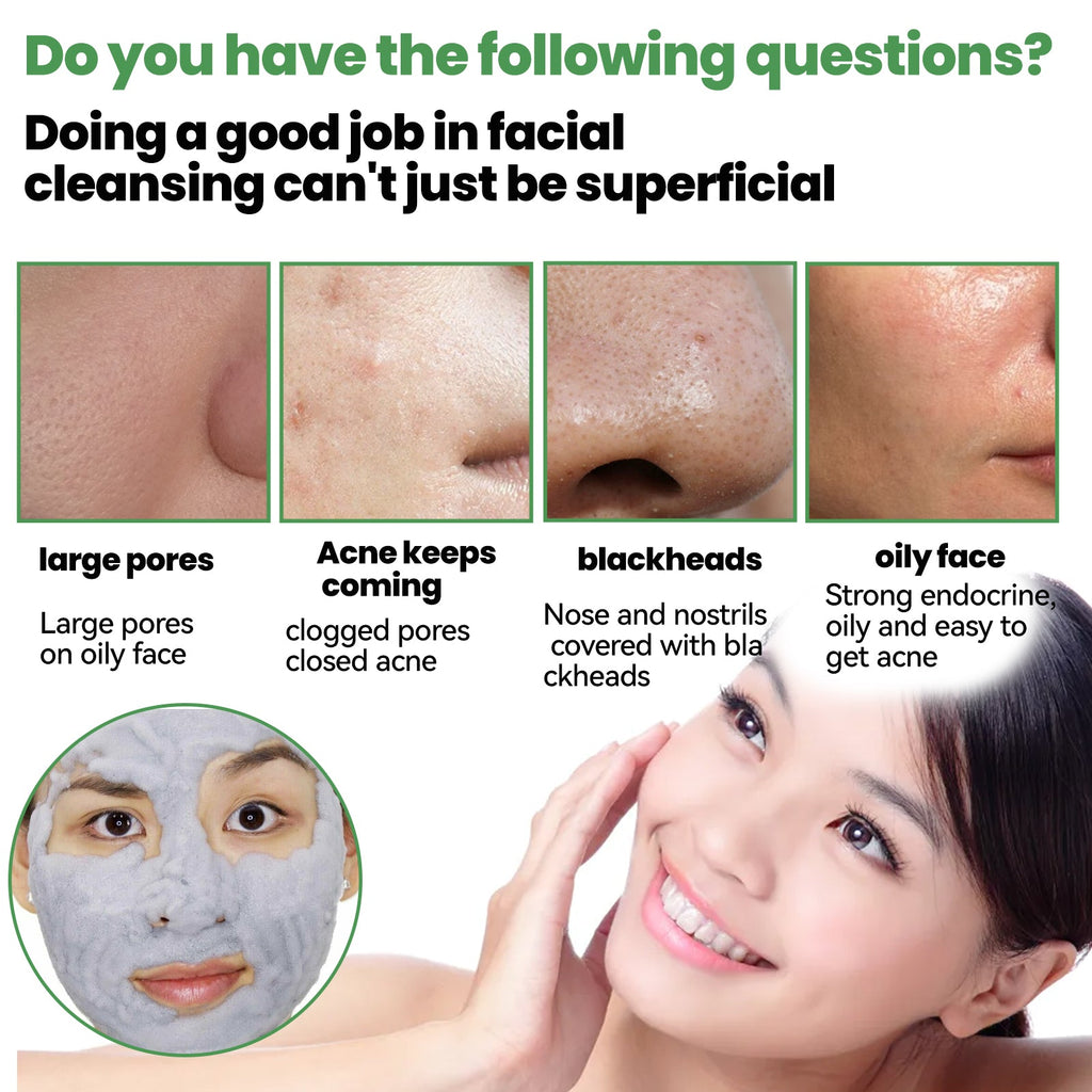 Eelhoe - Deep Cleaning Carbonated Bubble Mask
