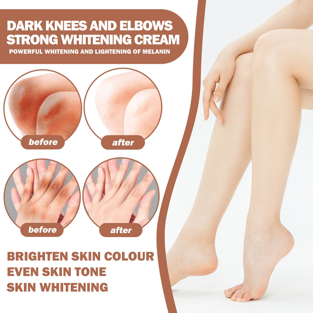 Eelhoe - Dark Knees & Elbows Whitening Cream