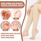 Eelhoe - Dark Knees & Elbows Whitening Cream