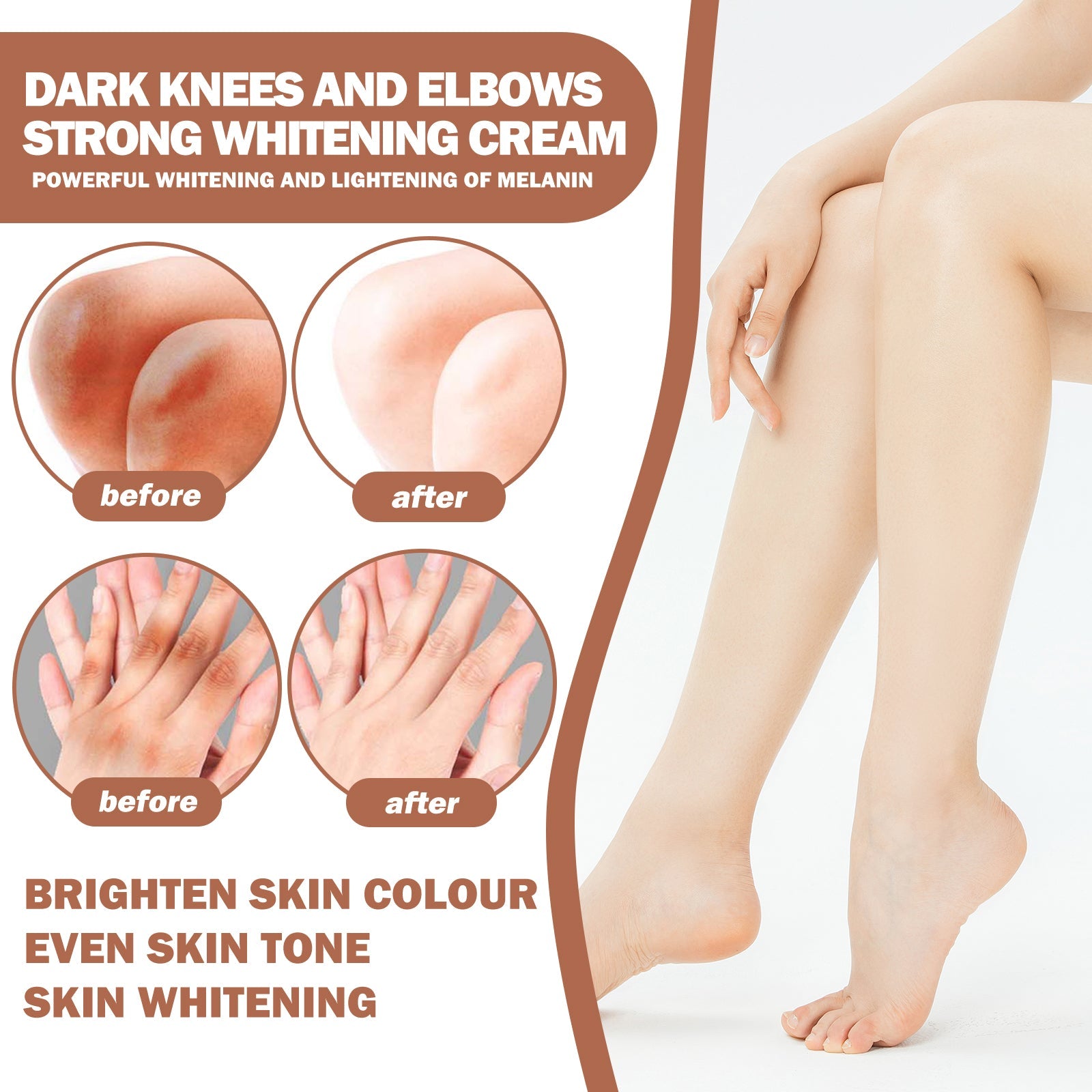 Eelhoe - Dark Knees & Elbows Whitening Cream