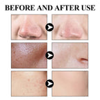 West & Month - Mugworts Acne Clay Stick