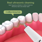 Dental Tools - 3-Speed Visible Ultrasonic Electric Tooth Cleaner
