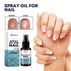 XiMonth - Spray Oil for Nails