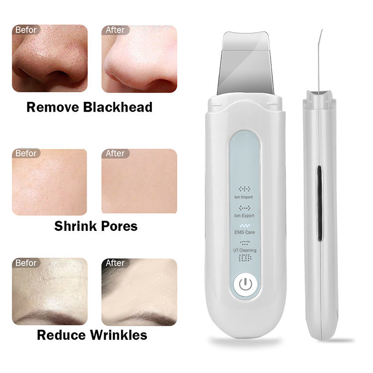 HailiCare - New Ultrasonic Peeling Machine