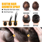 Eelhoe - Biotin Hair Growth Spray