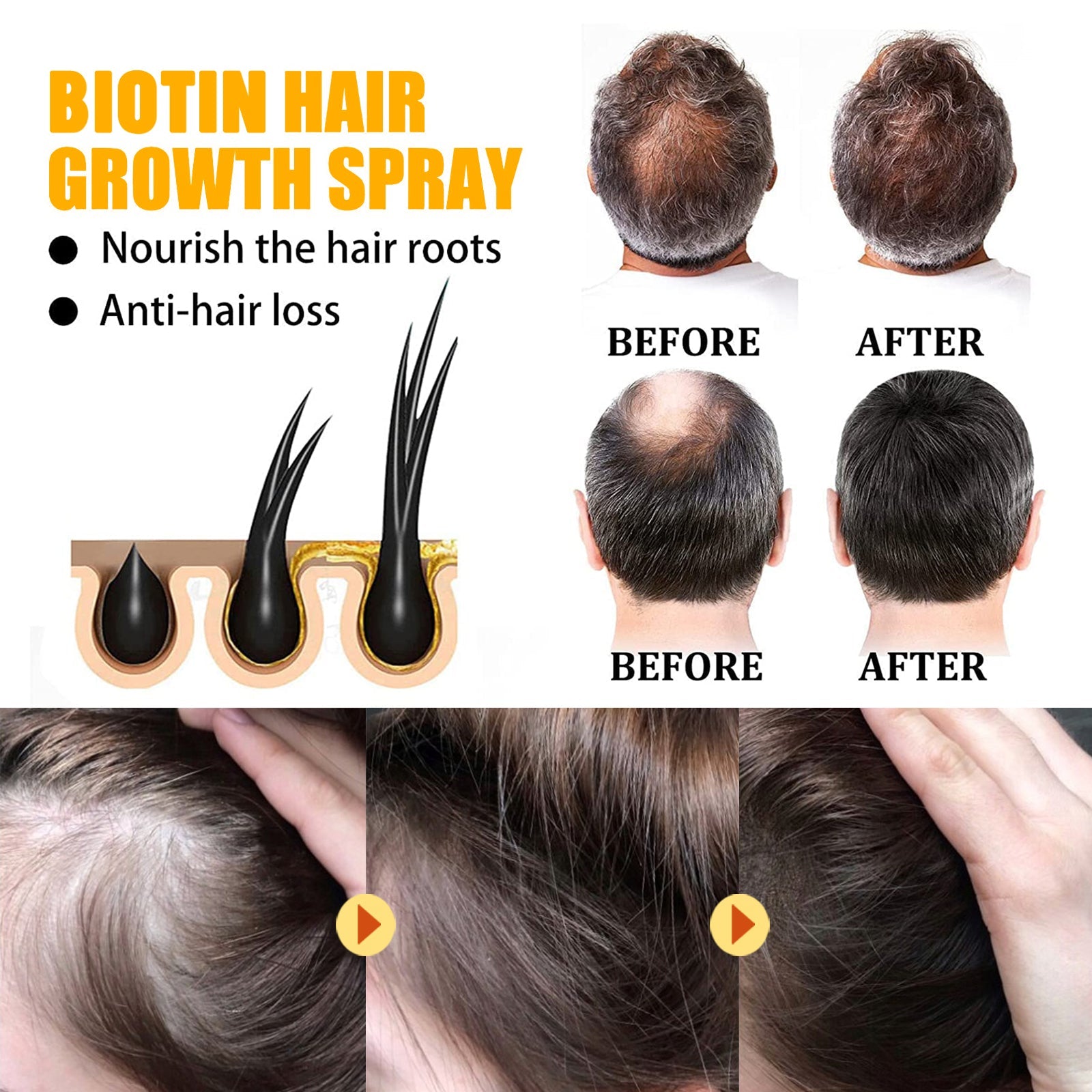 Eelhoe - Biotin Hair Growth Spray