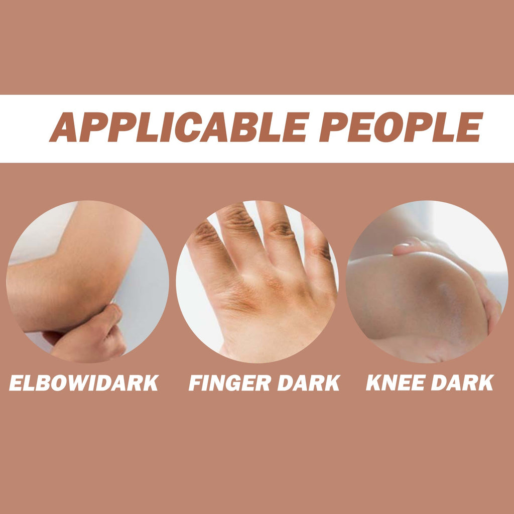 Eelhoe - Dark Knees & Elbows Whitening Cream
