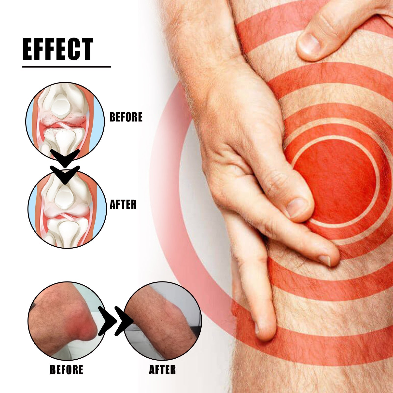 XiMonth - Joint and Bone Therapuetic Soak
