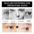 Hoygi - Hyaluronic Acid & Strawberry Extract Gel Eye Mask