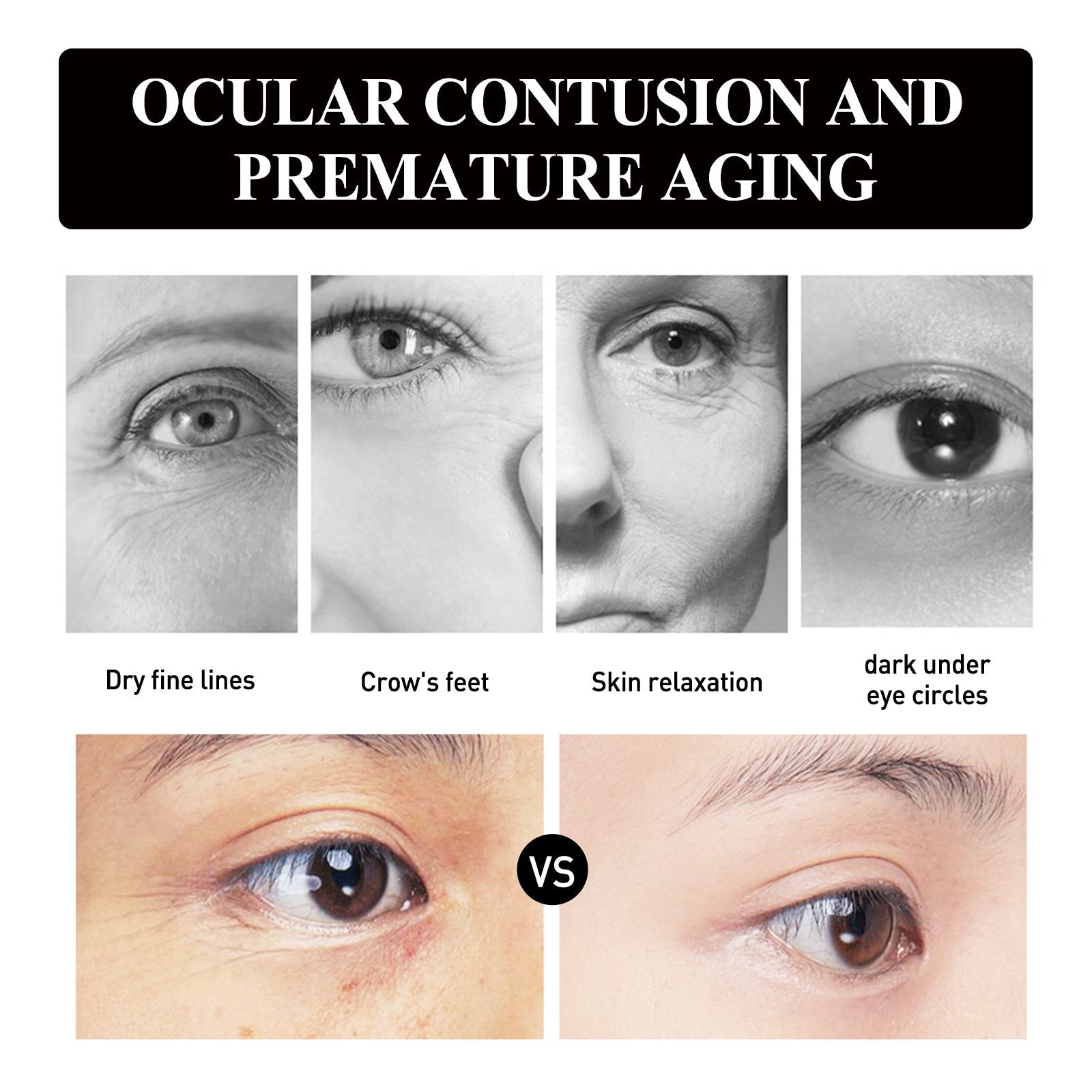 Hoygi - Hyaluronic Acid & Strawberry Extract Gel Eye Mask