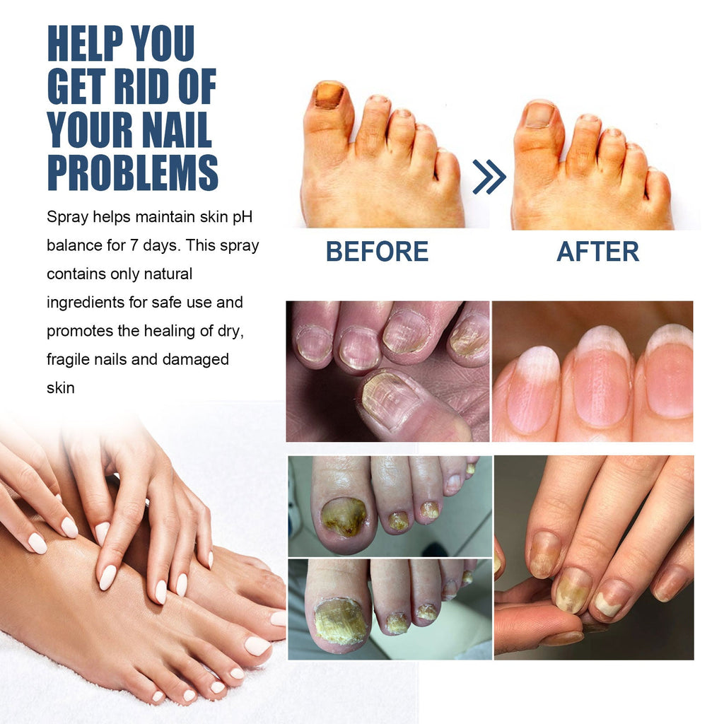 South Moon - Gray Nail Foot Spray