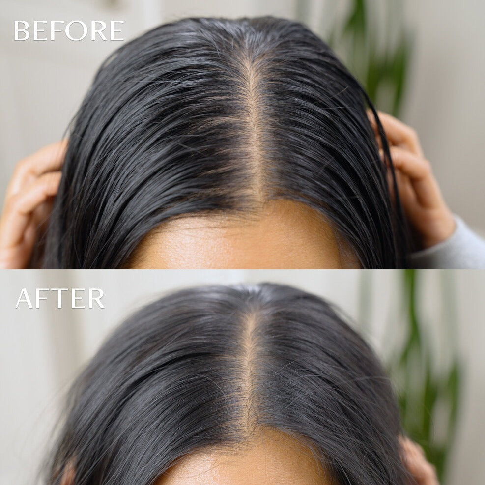 m’Chel Haircare - Day After™ Brush + Refill Bundle Clean Dry Shampoo