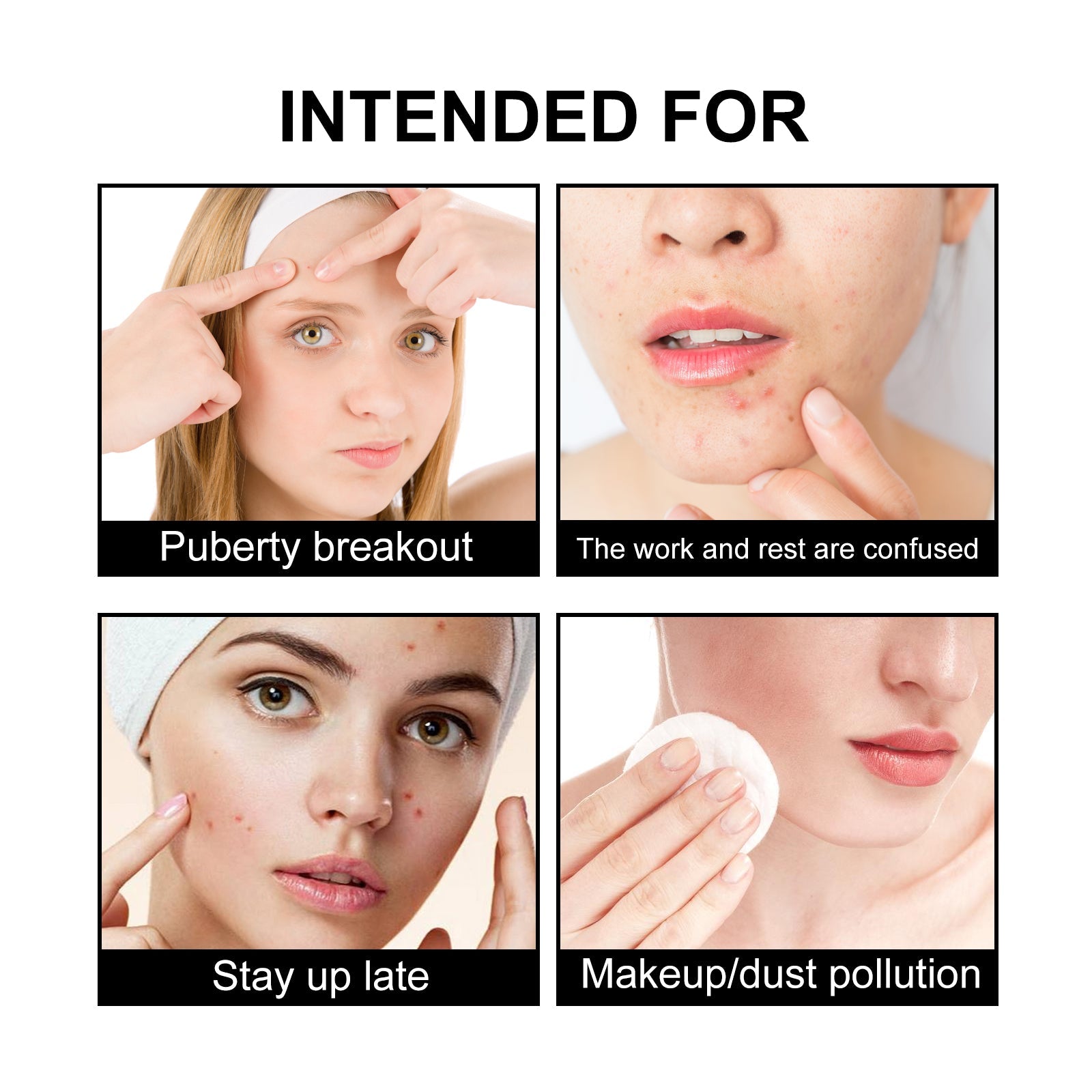 Jaysuing - Cute Black Acne Patch