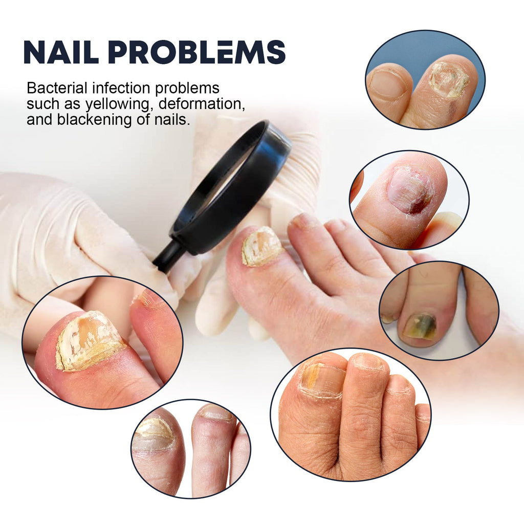 XiMonth - Spray Oil for Nails