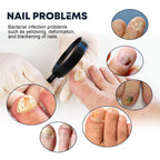 XiMonth - Spray Oil for Nails