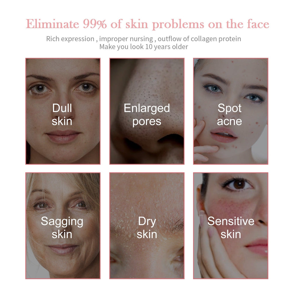 Jaysuing - 5-in-1 Facial Moisturizing Set