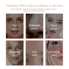 Jaysuing - 5-in-1 Facial Moisturizing Set