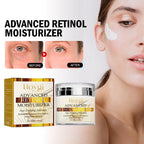 Hoygi - Advanced Retinol Moisturizer
