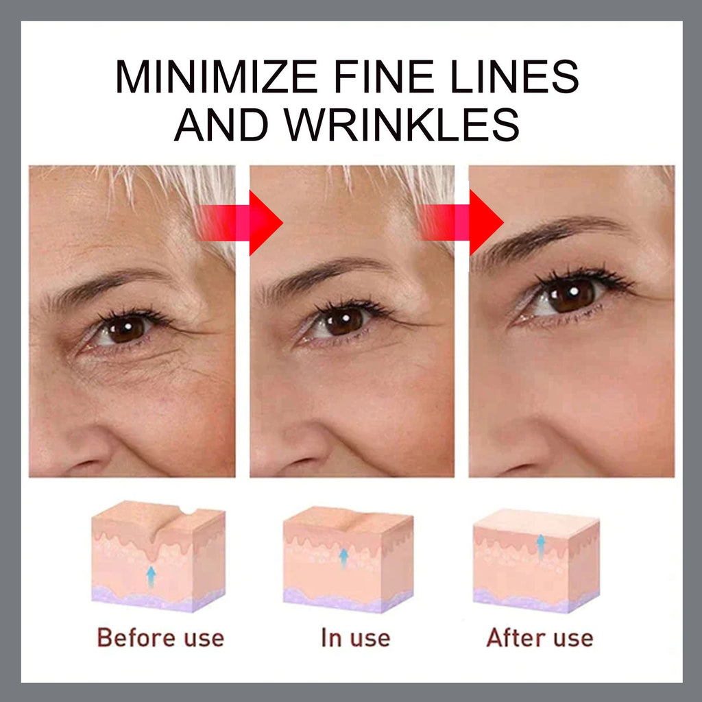 Hoygi - Advanced Retinol Moisturizer