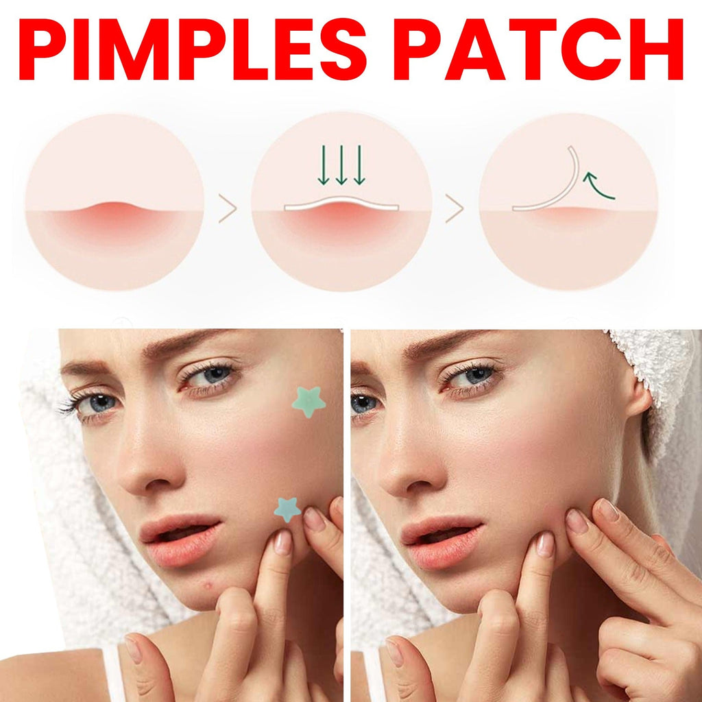 Jaysuing - Pimple Patch Professional Grade
