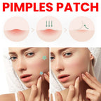 Jaysuing - Pimple Patch Professional Grade
