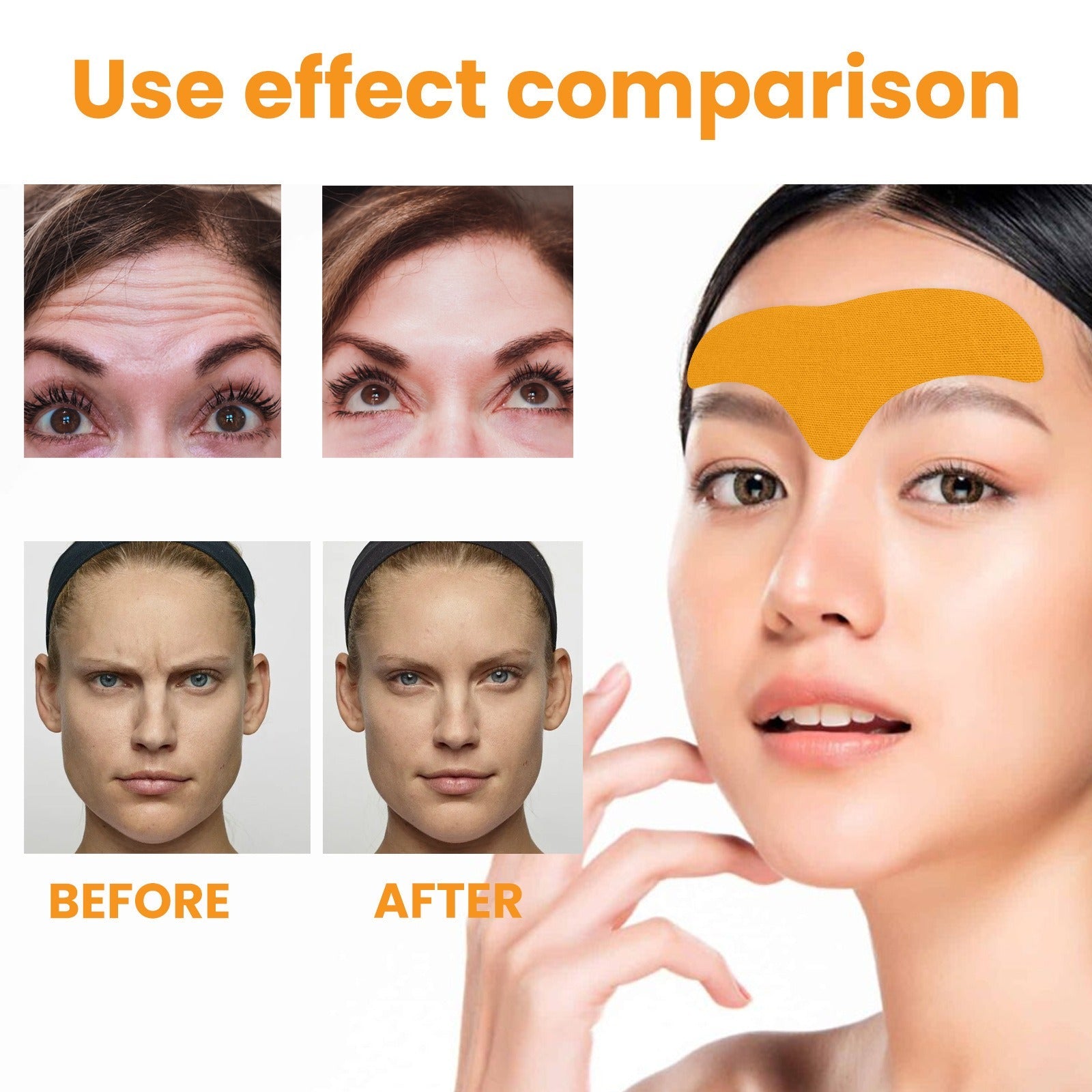 Eelhoe - Forehead Wrinkle Patch