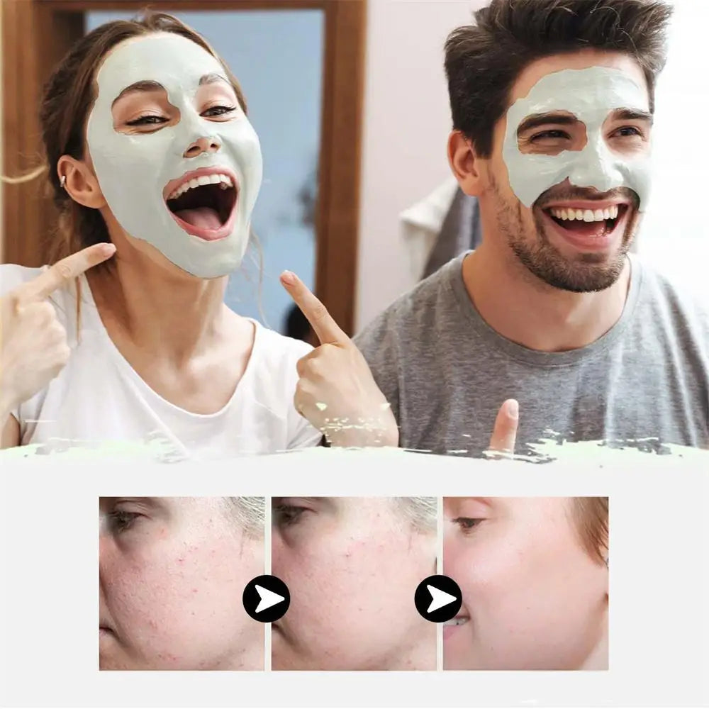 West & Month - Mugworts Acne Clay Stick