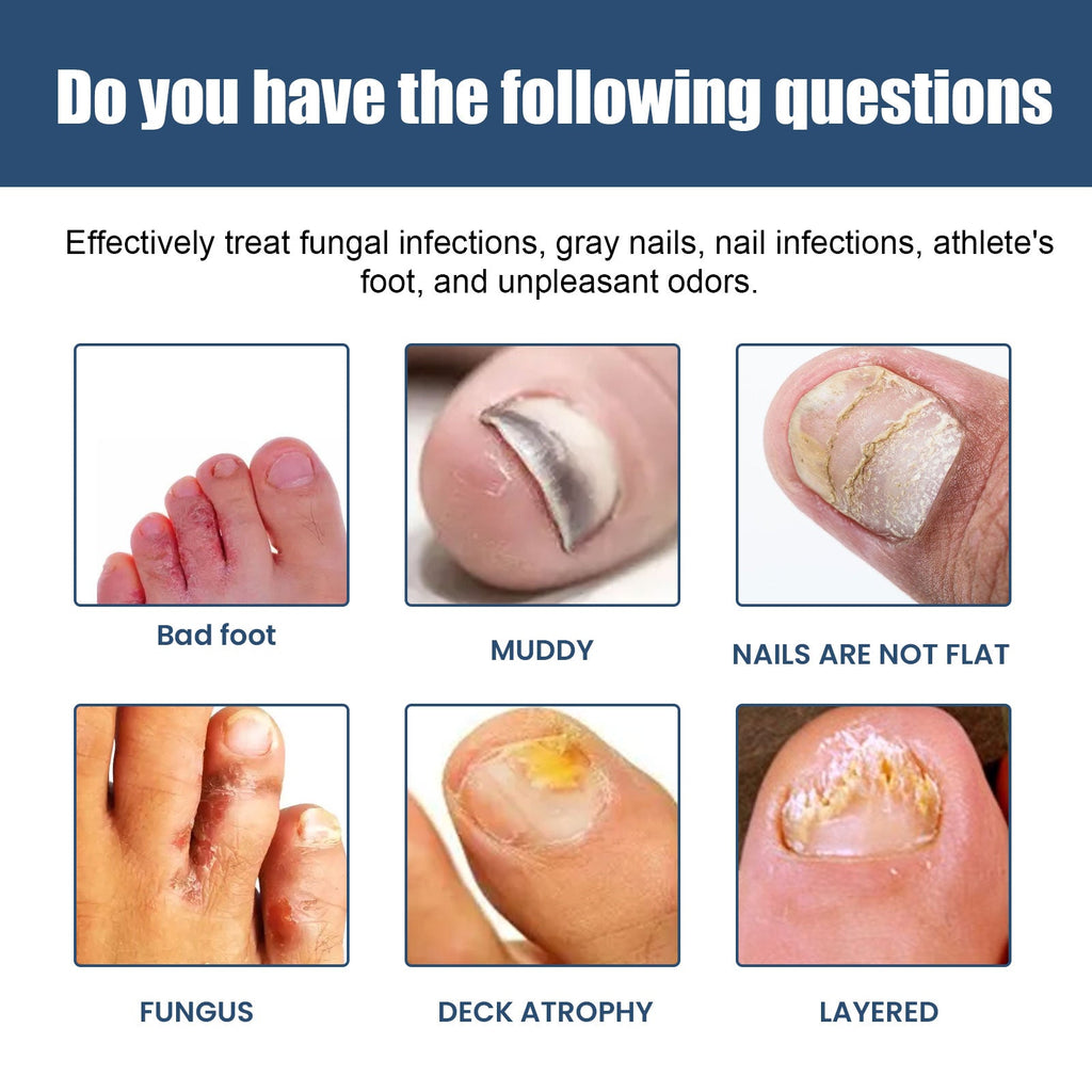 South Moon - Gray Nail Foot Spray