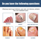 South Moon - Gray Nail Foot Spray