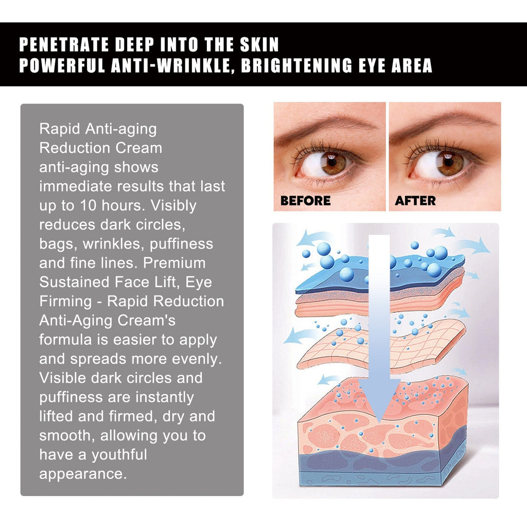 Hoygi - Hyaluronic Acid & Strawberry Extract Gel Eye Mask
