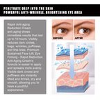 Hoygi - Hyaluronic Acid & Strawberry Extract Gel Eye Mask