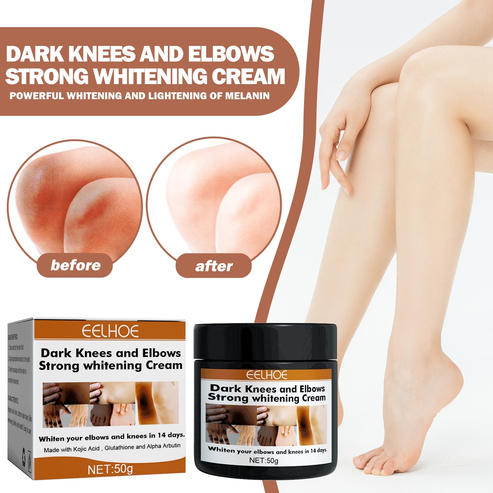 Eelhoe - Dark Knees & Elbows Whitening Cream