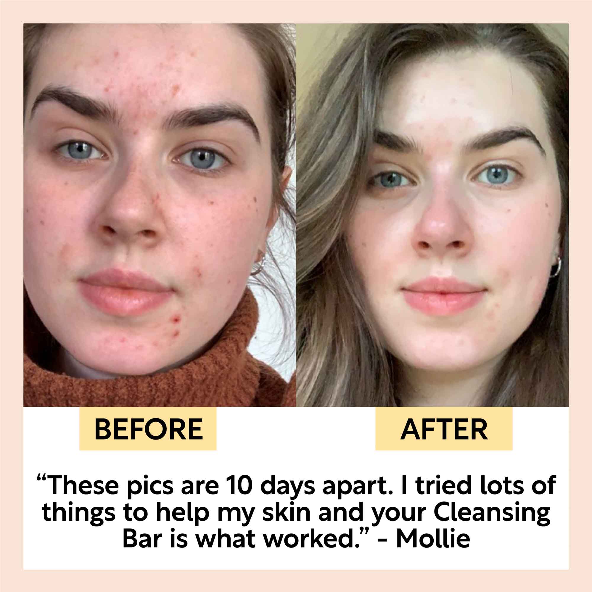 UpCircle - Chai Soap Cleansing Duo