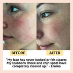 UpCircle - Chai Soap Cleansing Duo