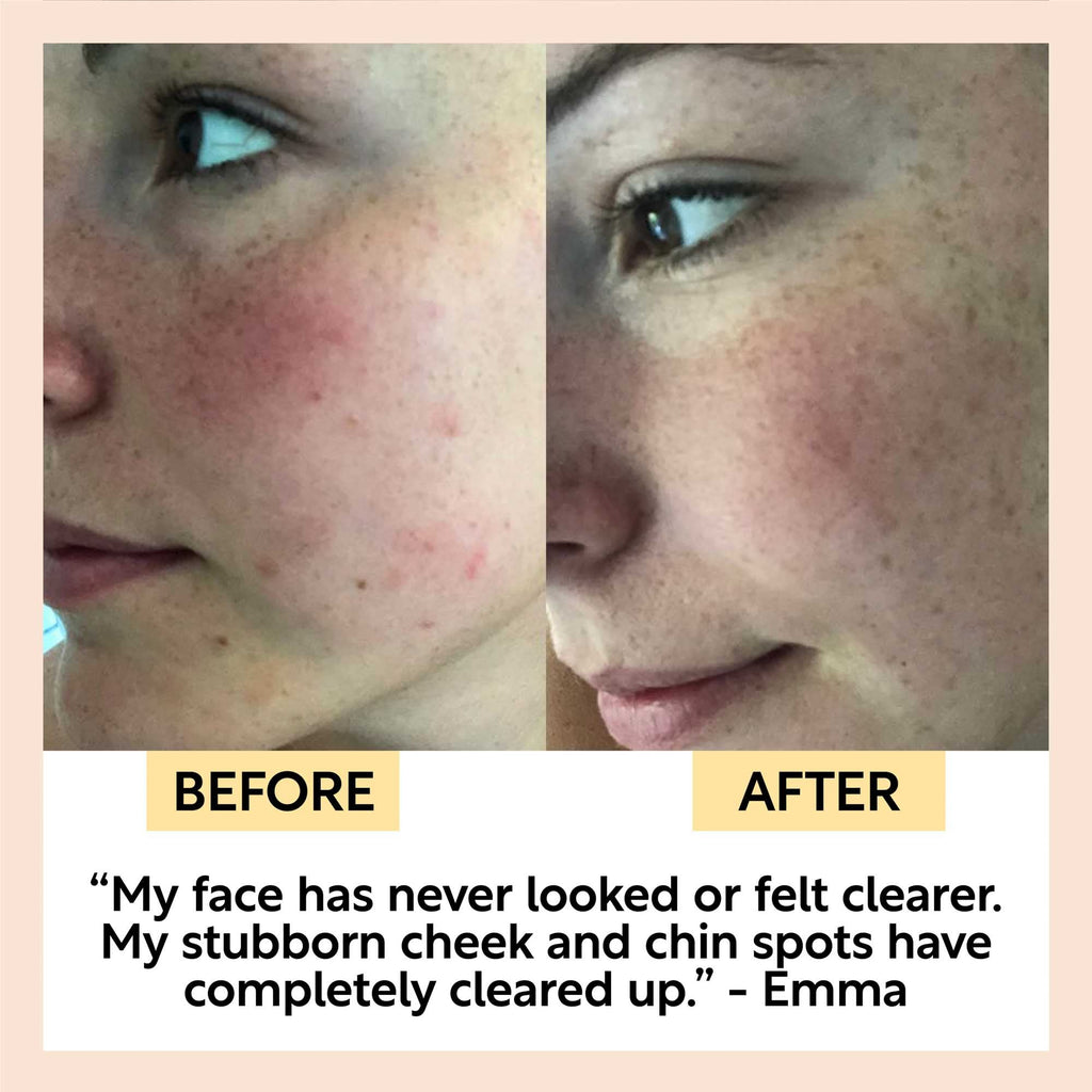 UpCircle - Cinnamon + Ginger Cleansing Bar