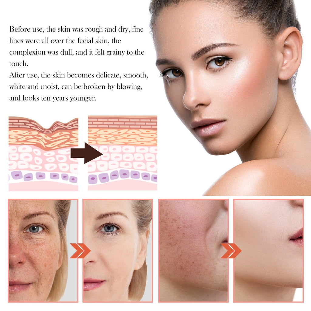 Jaysuing - 5-in-1 Facial Moisturizing Set