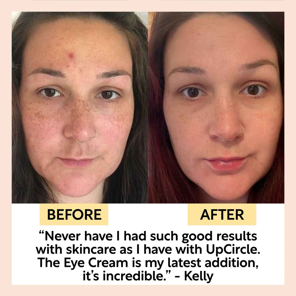 UpCircle - Eye Cream with Hyaluronic Acid & Coffee