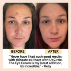 UpCircle - Eye Cream with Hyaluronic Acid & Coffee