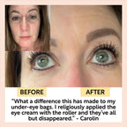 UpCircle - Eye Cream with Hyaluronic Acid & Coffee