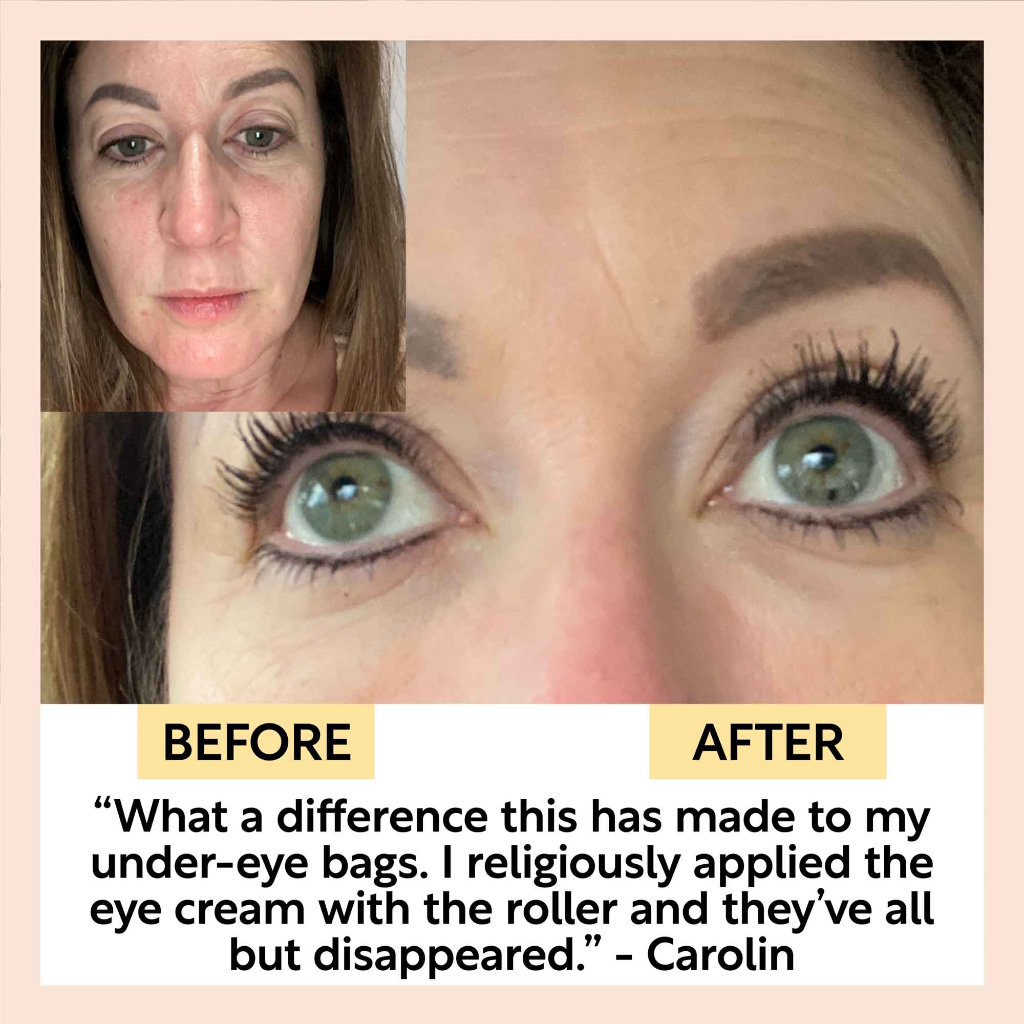 UpCircle - Eye Cream with Hyaluronic Acid & Coffee