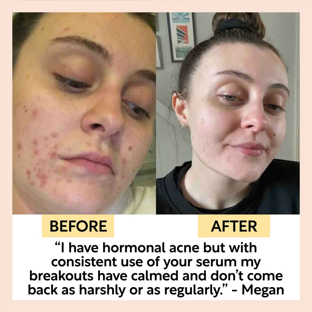 UpCircle - Organic Face Oil with Coffee Extact - Travel Size