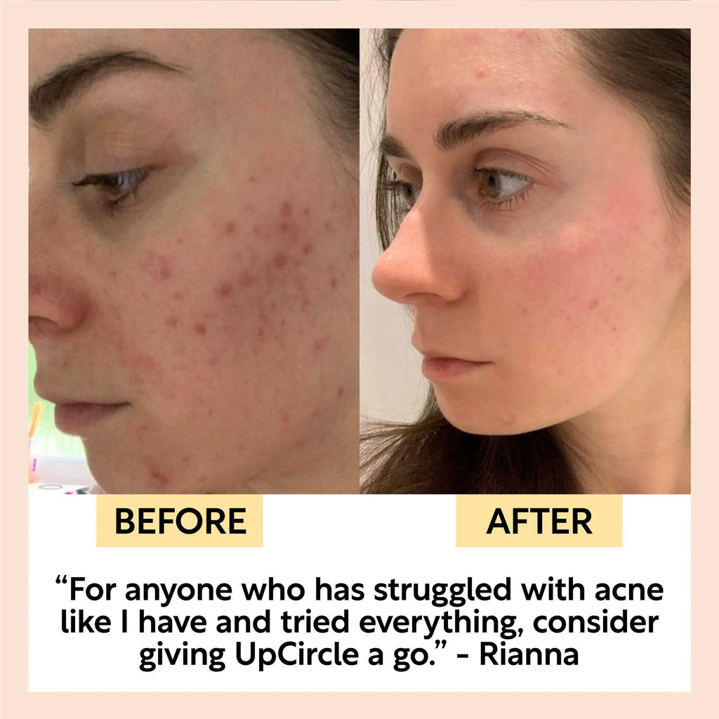 UpCircle - Face Toner with Hyaluronic Acid - Travel Size