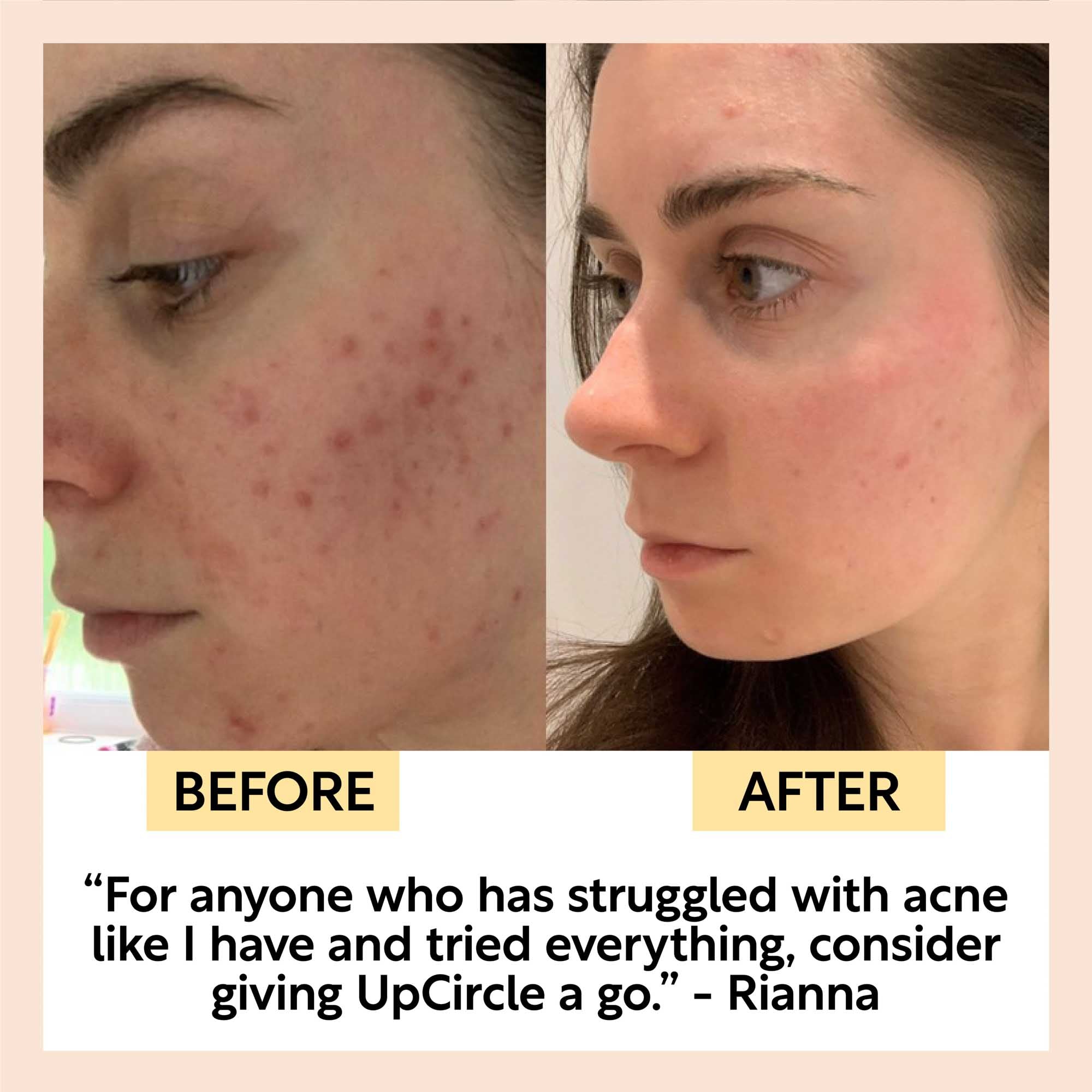 UpCircle - Face Toner with Hyaluronic Acid - Travel Size