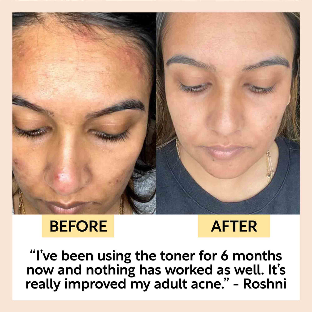 UpCircle - Face Toner with Hyaluronic Acid - Travel Size
