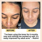 UpCircle - Face Toner with Hyaluronic Acid - Travel Size